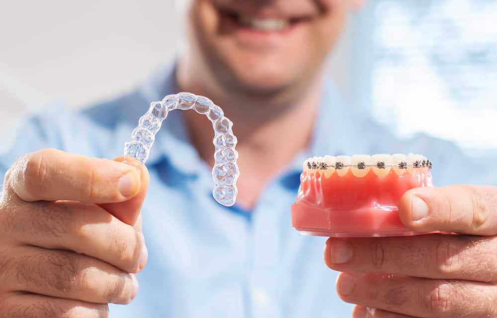 Invisalign vs braces: which is faster?